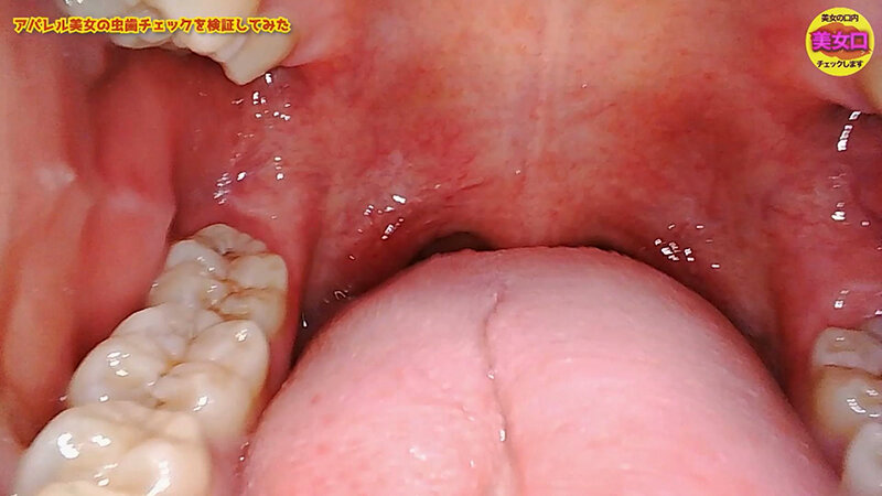 お口の中をじっくり見せてくれませんか?~アパレル店員はるのさん~ 安堂はるの 4